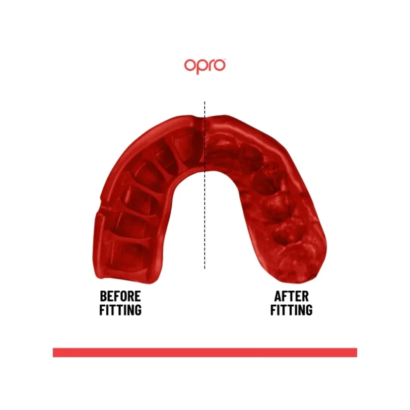 Opro Gold Jawz Senior szájvédő - fekete/arany