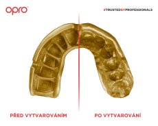 Chránič zubov Opro Instant Custom Fit HU Senior