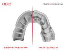 Opro Silver Senior mouthguard - transparent